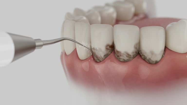 Trusted Emergency Dentist service in Ettrick, VA - Dentist Open Now